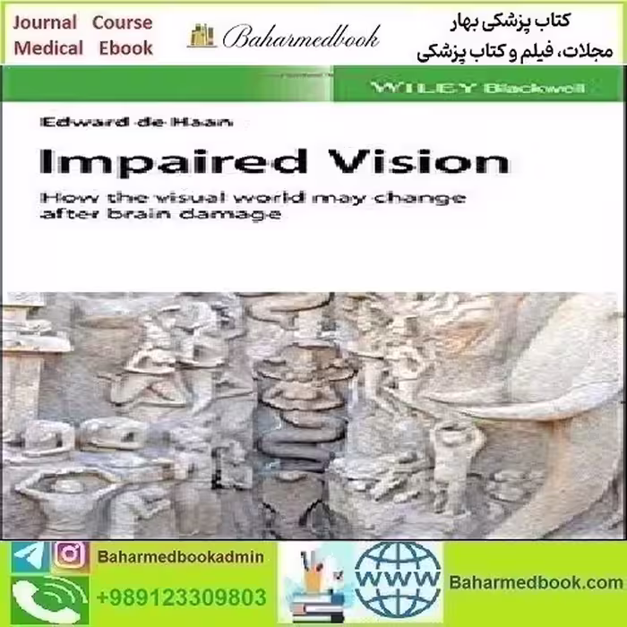 Impaired Vision How the Visual World May Change after Brain