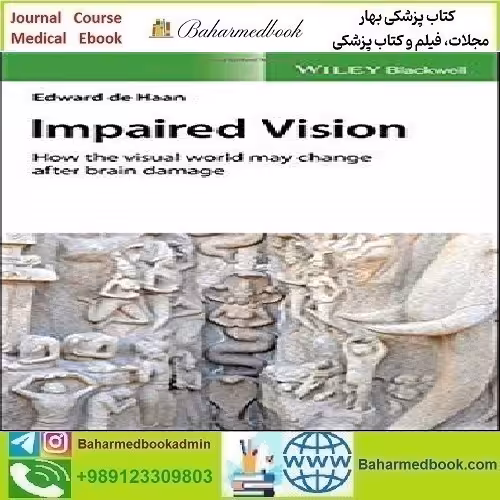 Impaired Vision How the Visual World May Change after Brain