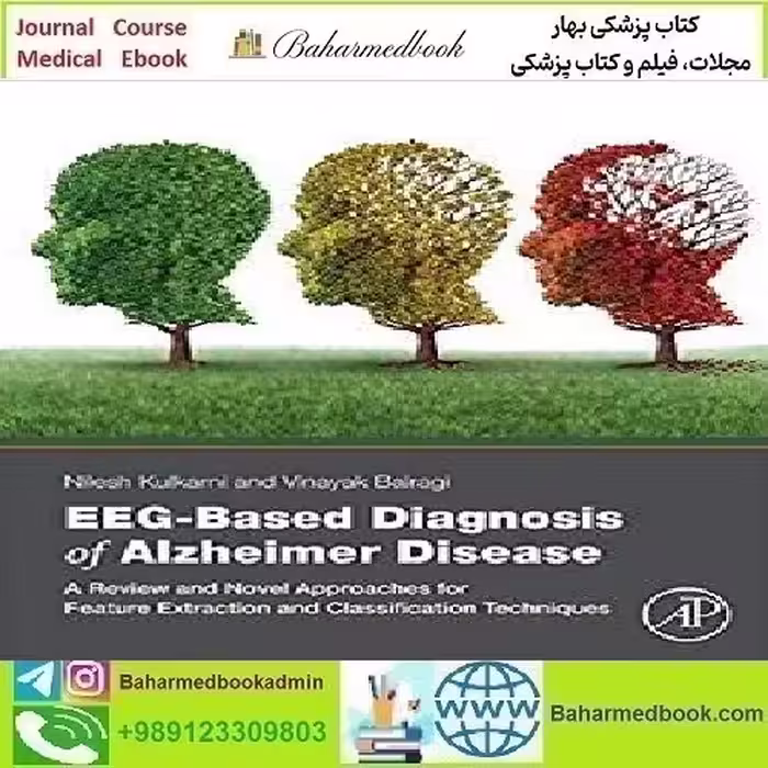 EEG Based Diagnosis of Alzheimer Disease 2019