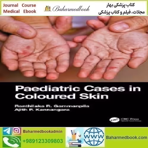Paediatric Cases in Coloured Skin 2024 TRUE PDF price 1€ - کتاب پزشکی بهار