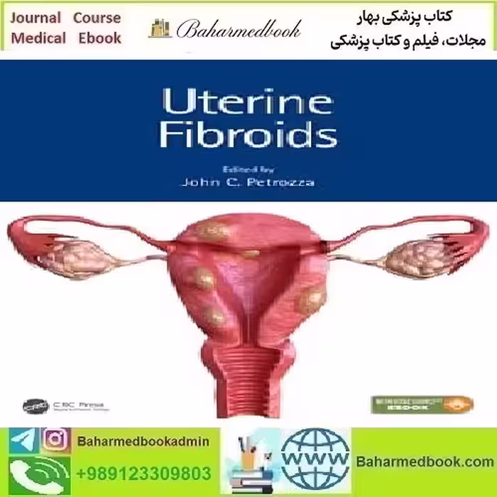 Uterine Fibroids 2021 TRUE PDF price 1€ - کتاب پزشکی بهار