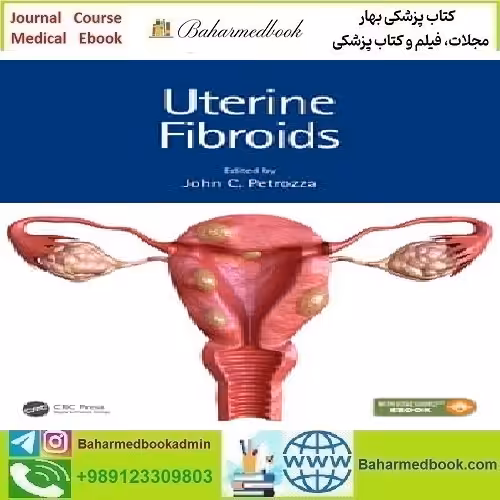 Uterine Fibroids 2021 TRUE PDF price 1€ - کتاب پزشکی بهار