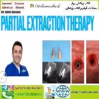 Partial Extraction Therapy Course video course price 34€ - کتاب پزشکی بهار
