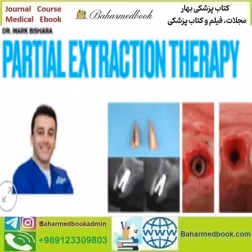 Partial Extraction Therapy Course video course price 34€ - کتاب پزشکی بهار
