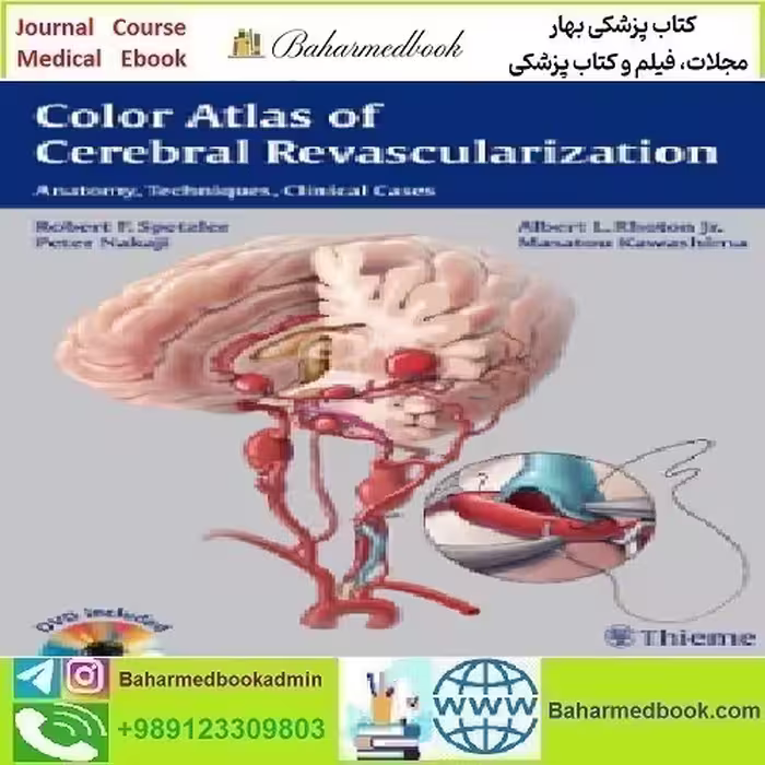 Color Atlas of Cerebral Revascularization Anatomy Techniques C