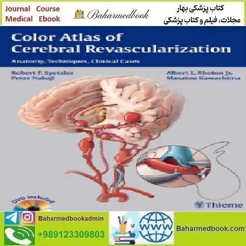 Color Atlas of Cerebral Revascularization Anatomy Techniques C