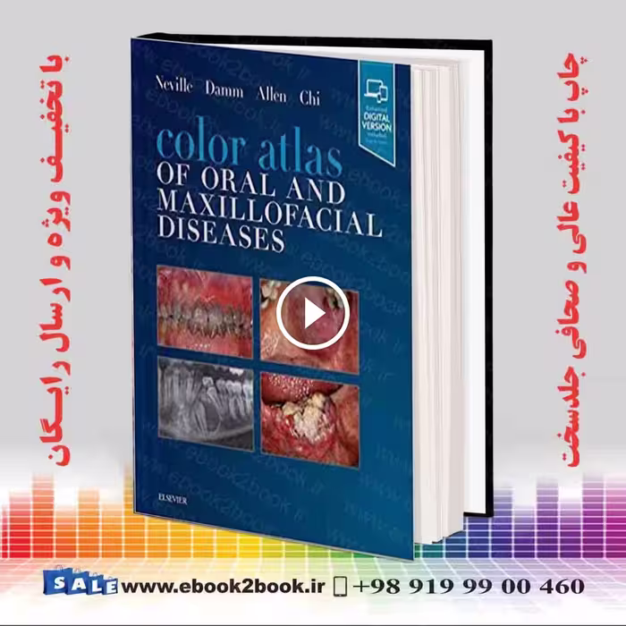 Color Atlas of Oral and Maxillofacial Diseases