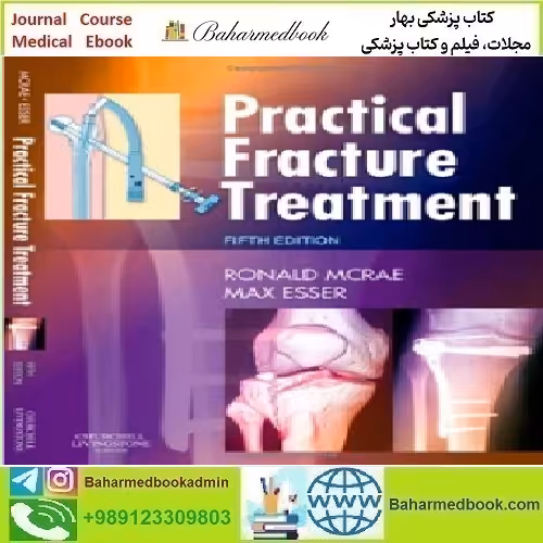Practical Fracture Treatment 2009 TRUE PDF price 1€ - کتاب پزشکی بهار