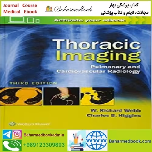 Thoracic Imaging Pulmonary and Cardiovascular Radiology C