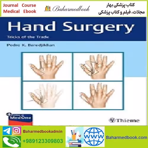 Hand Surgery TRUE PDF price 1€