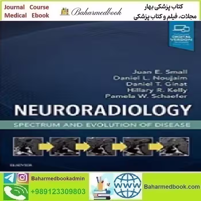 Neuroradiology Spectrum and Evolution of Disease