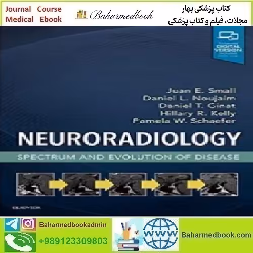 Neuroradiology Spectrum and Evolution of Disease