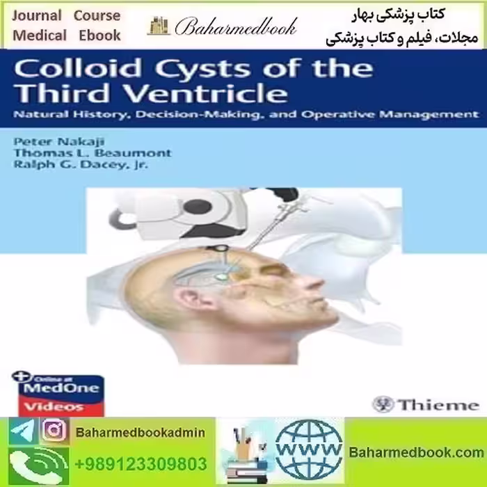 Colloid Cysts of the Third Ventricle Natural History Decision-Making