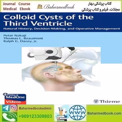 Colloid Cysts of the Third Ventricle Natural History Decision-Making