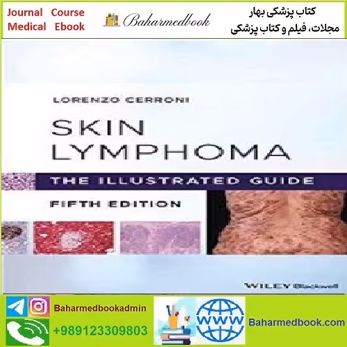 Skin Lymphoma The Illustrated Guide TRUE PDF price 1€ - کتاب پزشکی بهار