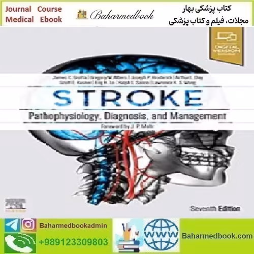 Stroke Pathophysiology Diagnosis and Management 2022 T