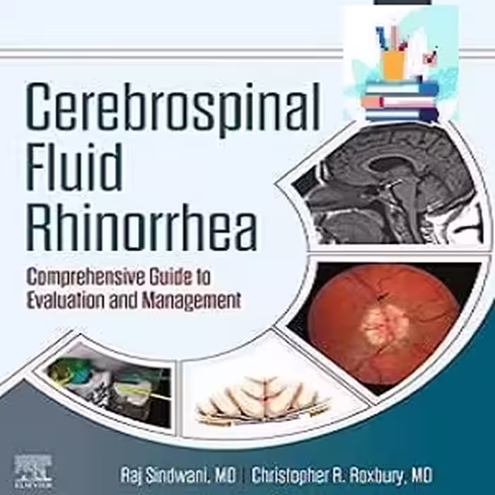 Cerebrospinal Fluid Rhinorrhea Comprehensive Guide*BAHARMEDBOOK