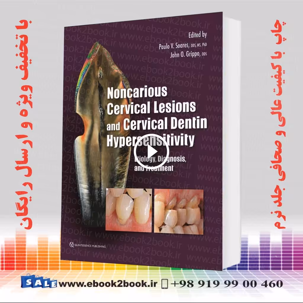 Noncarious Cervical Lesions