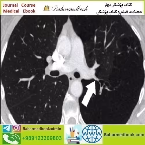 ARRS Basic Chest Imaging 2019 video course price 35€ - کتاب پزشکی بهار
