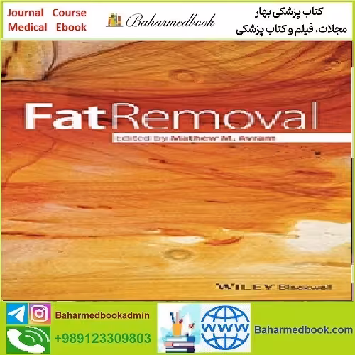 Fat Removal TRUE PDF price 1€ - کتاب پزشکی بهار