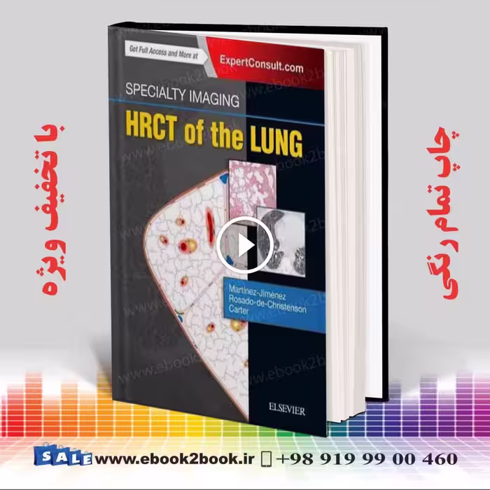 Specialty Imaging: HRCT of the Lung 2nd Edition