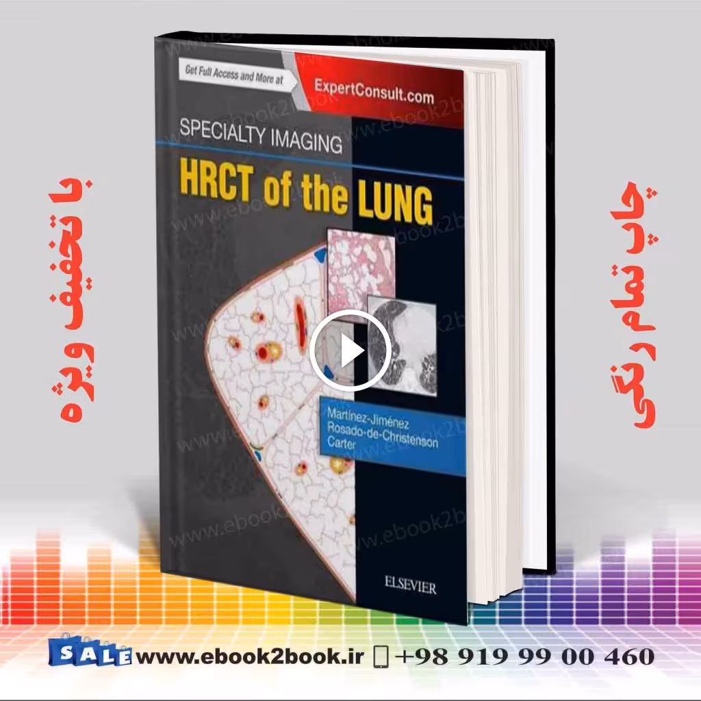 Specialty Imaging: HRCT of the Lung 2nd Edition