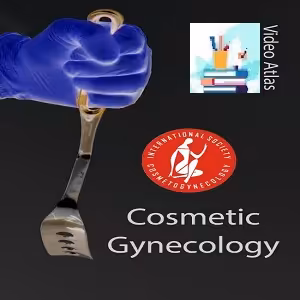 ISCG Video Atlas of Cosmetic Gynecology at 10€ - کتاب پزشکی بهار