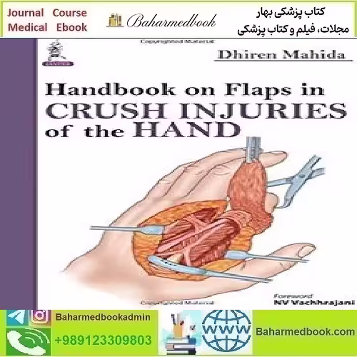 Handbook on Flaps in Degloving, Avulsion and Crush Injuries