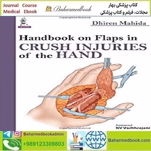 Handbook on Flaps in Degloving, Avulsion and Crush Injuries