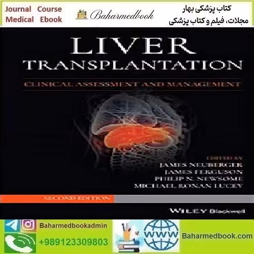 Liver Transplantation Clinical Assessment and Management