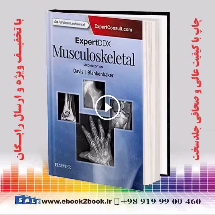 ExpertDDx: Musculoskeletal 2nd Edition