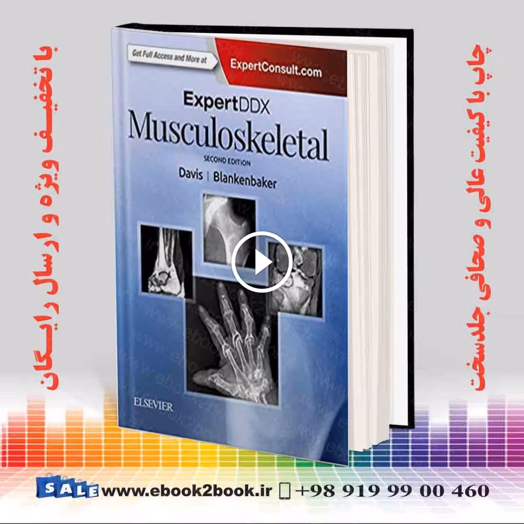 ExpertDDx: Musculoskeletal 2nd Edition