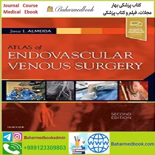 Atlas of Endovascular Venous Surgery TRUE PDF price 1€ - کتاب پزشکی بهار