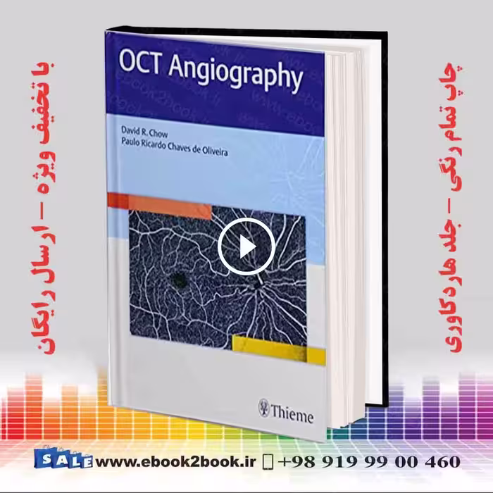 OCT Angiography