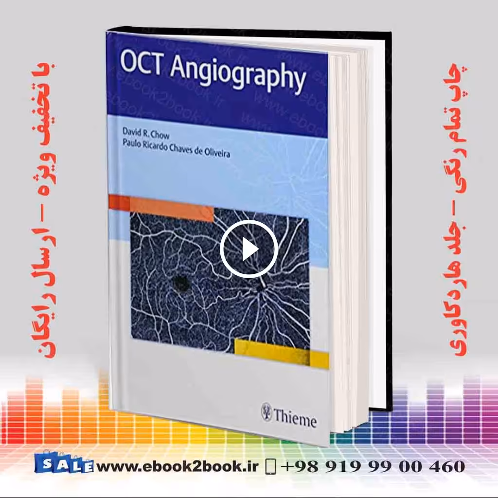 OCT Angiography