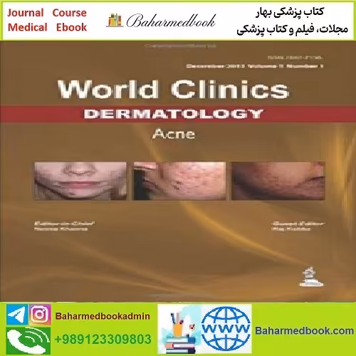 Acne World Clinics in Dermatology TRUE PDF price 1€ - کتاب پزشکی بهار