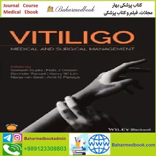 Vitiligo Medical and Surgical Management TRUE PDF price 1€ - کتاب پزشکی بهار