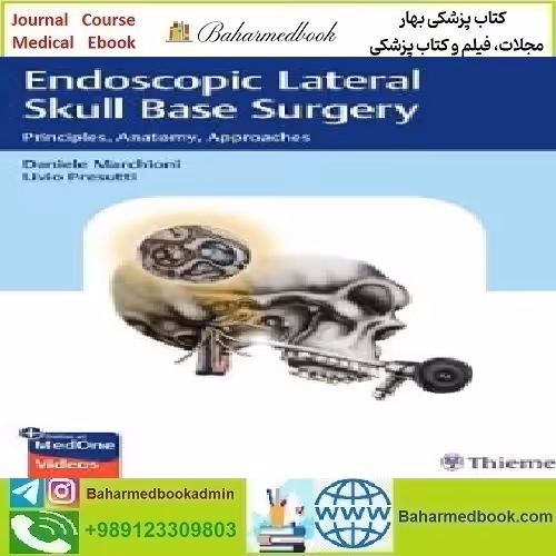 Endoscopic Lateral Skull Base Surgery Principles Anatomy Approac