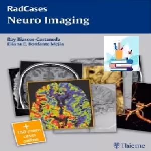 Neuro Imaging TRUE PDF price 1€