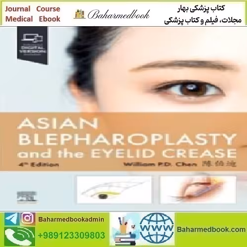 Asian Blepharoplasty and the Eyelid Crease 4th Edition 2