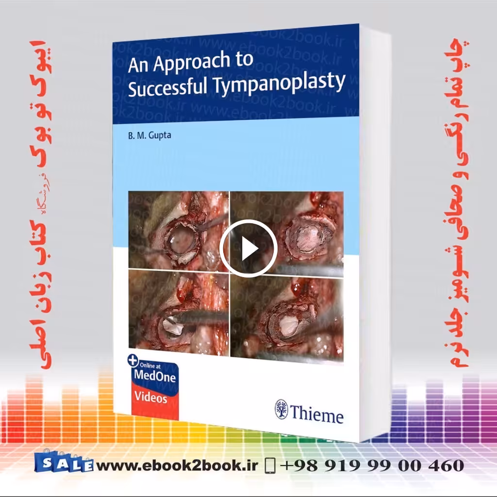 An Approach to Successful Tympanoplasty
