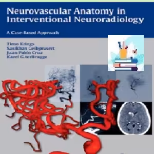 Neurovascular Anatomy in Interventional Neuroradiology TRUE