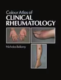 [PDF] دانلود کتاب Colour Atlas Of Clinical Rheumatology, 1985