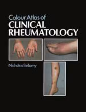 [PDF] دانلود کتاب Colour Atlas Of Clinical Rheumatology, 1985