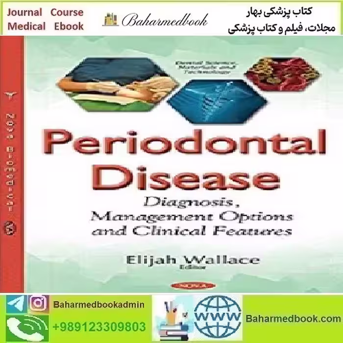Periodontal Disease Diagnosis Management Options and C