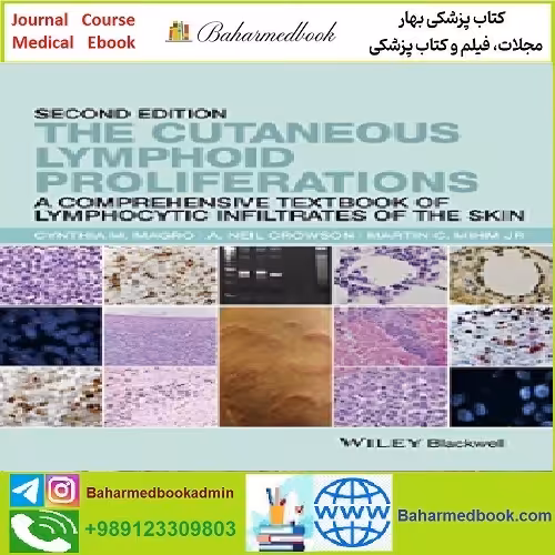 The Cutaneous Lymphoid Proliferations TRUE PDF price 1€ - کتاب پزشکی بهار