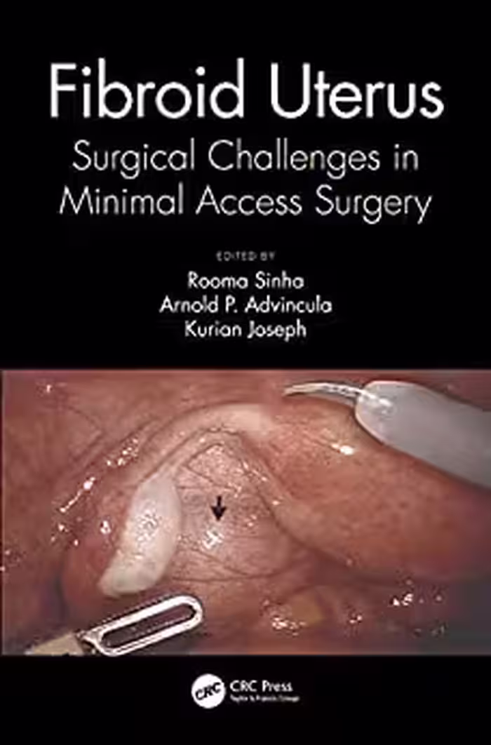 Fibroid Uterus, 1ed 2021 - کتاب پزشکی بهار
