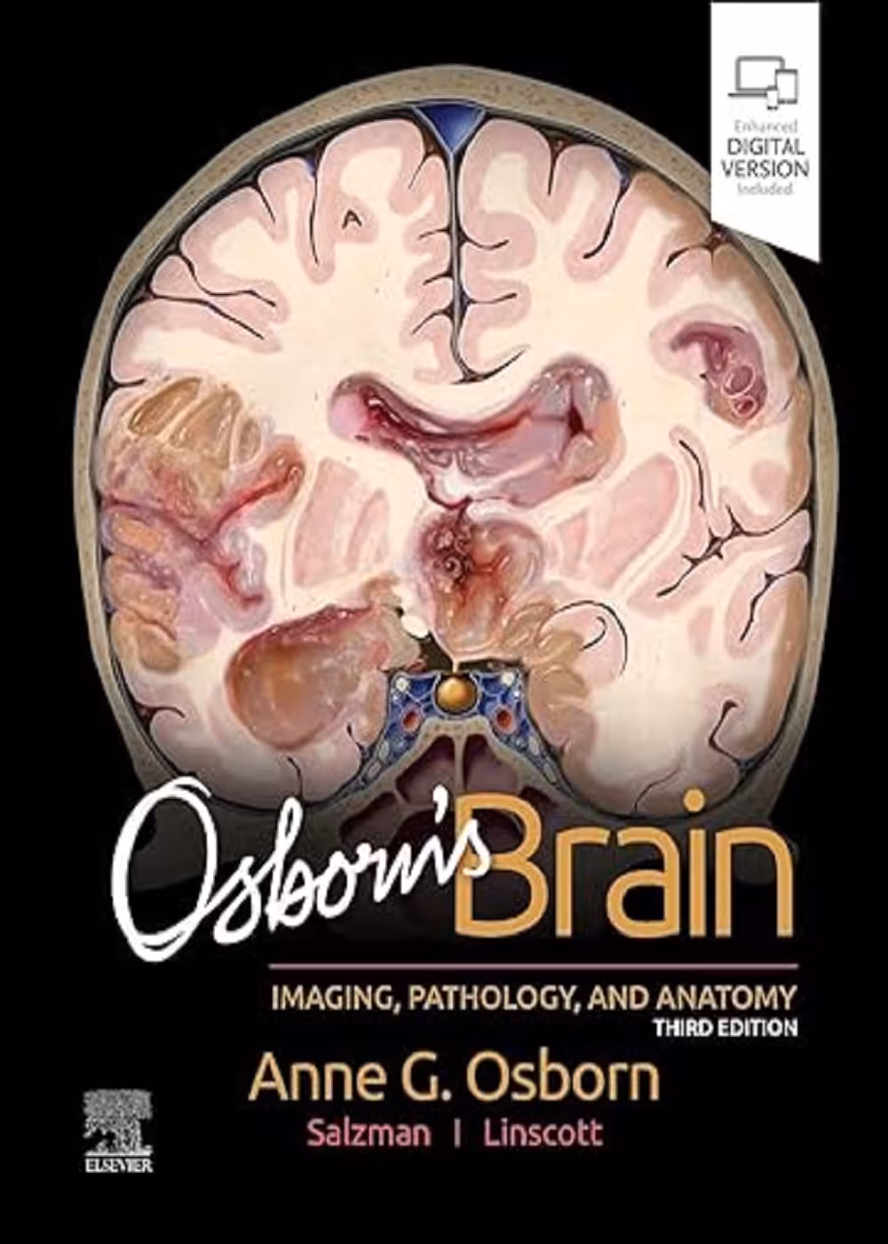 Osborn’s Brain imaging pathology and anatomy 2024-3th مغز آزبورن