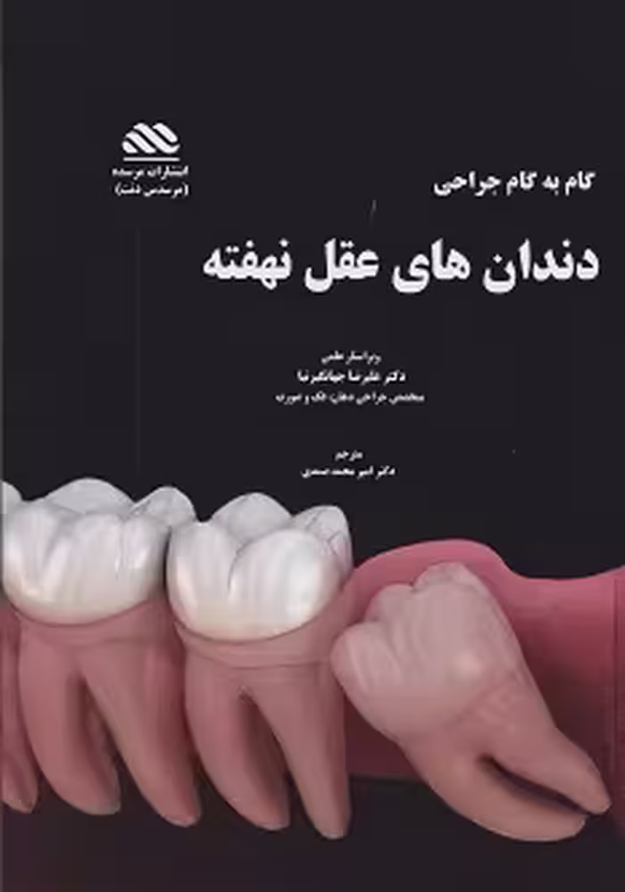جراحی دندان های عقل نهفته