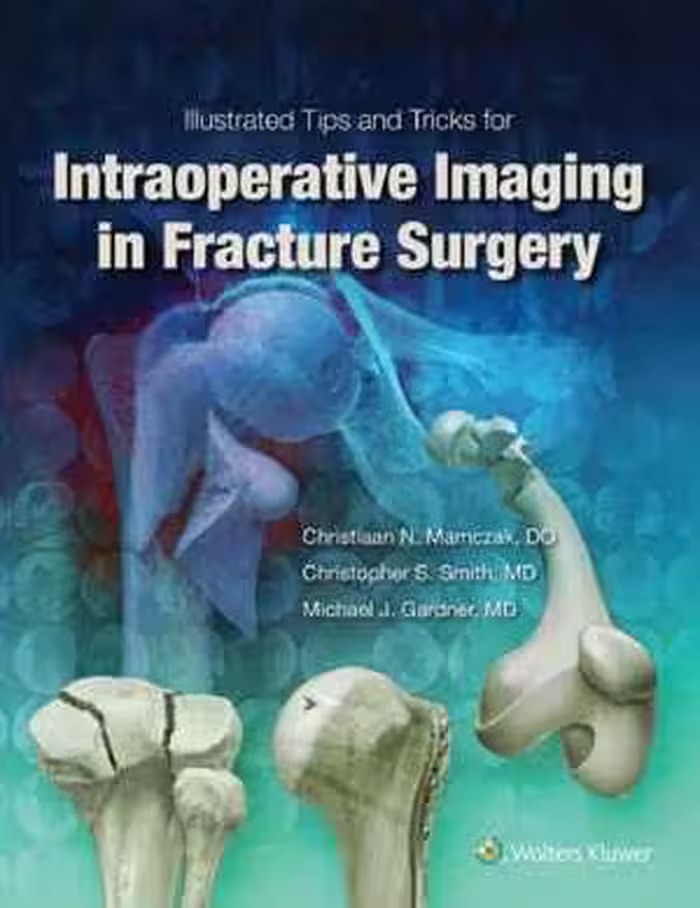 [PDF] دانلود کتاب Illustrated Tips And Tricks For Intraoperative Imaging In Fracture Surgery, 2017
